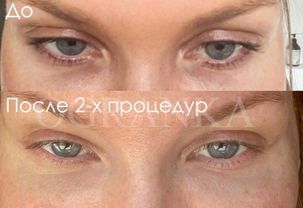 Kv1MG_bL_KsNMYwASnnePLpwMhVVtaEGHX3UD3hDm1DZdPdMX7NOsVdvTyR44rR_sGbe_DKKdeiT9GbNFqeudjrW